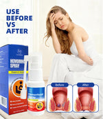 Load image into Gallery viewer, Herbal Hemorr.hoids Spray
